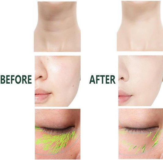 DermaLift 3X Facial